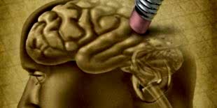 За больными Альцгеймером